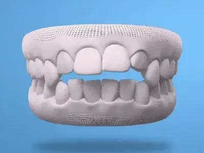 invisalign-3-steps-converted