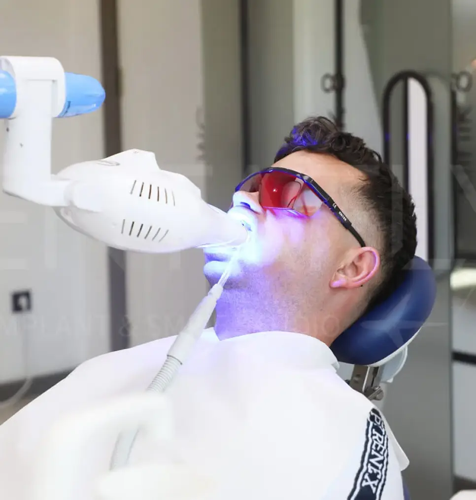 planned-around-your-shade-smile-and-oral-health