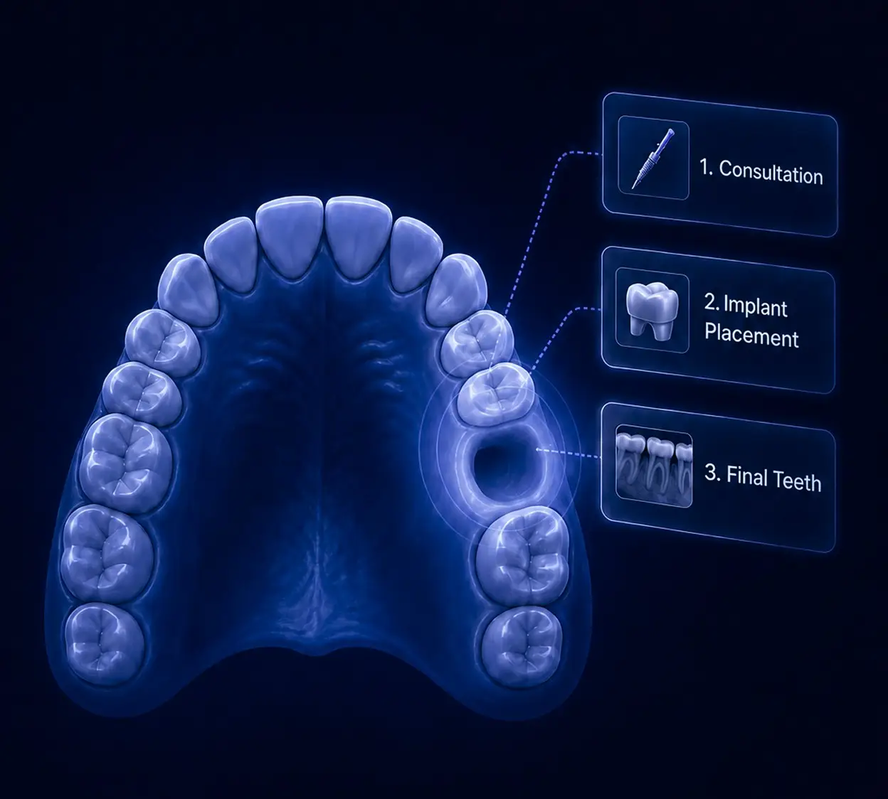 a-secure-solution-for-missing-teeth